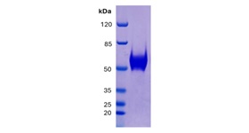 CD14 figure 1