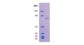 FLA-R1 Fig1