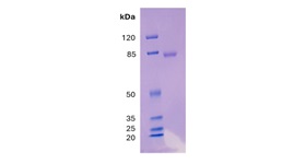 FLB-R1 Fig1