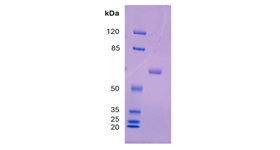 LBP Figure 1