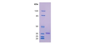 RBD Fig 1